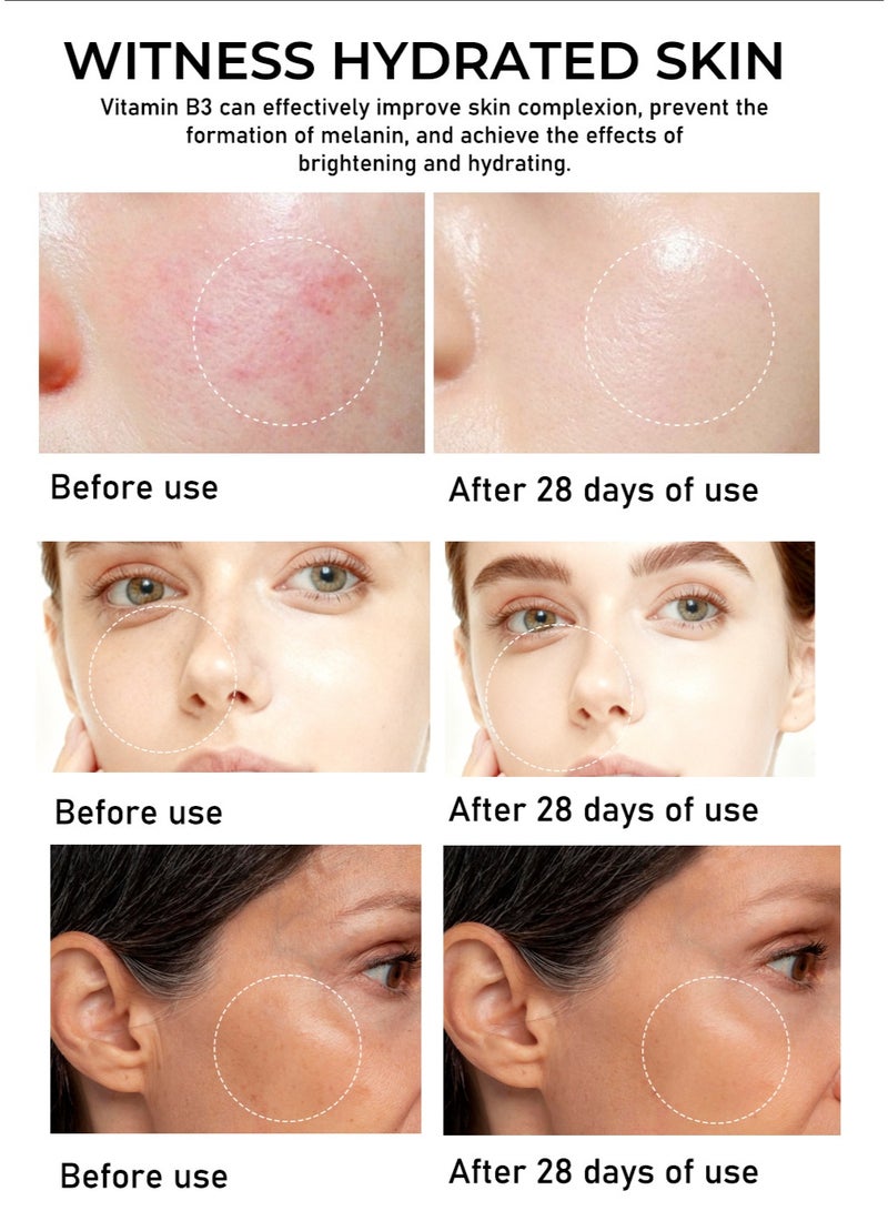 ام اس ال اي ام سيروم فيتامين ب3 (نياسيناميد) لتفتيح البشرة وإزالة البقع الداكنة: يضيء لون البشرة، يخفف من البقع الداكنة، ويحسن مظهر البشرة الباهتة (30 مل) - Image 4